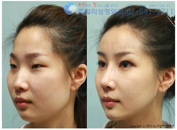 �؍��̍ŐV���e���` �W���G���[���`�O��