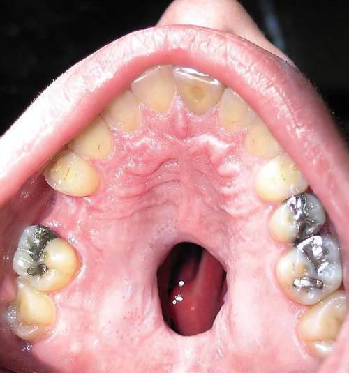 �R�J�C���̏�p�ɂ���Č��W�Ɍ�