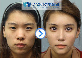 �؍��̍ŐV���e���` �W���G���[���`�O��