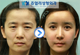 �؍��̍ŐV���e���` �W���G���[���`�O��