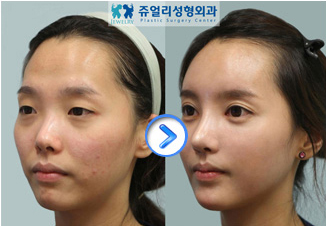 �؍��̍ŐV���e���` �W���G���[���`�O��